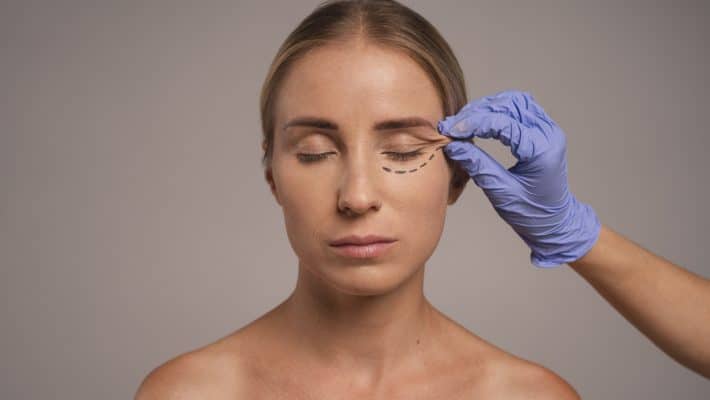 Paupières tombantes : quand envisager une blépharoplastie ?